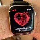 How to use the ECG App on Apple Watch